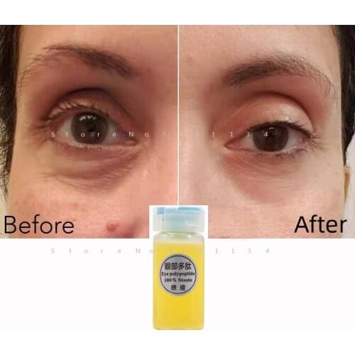 Instant Under Eye Serum Cream Gel Remove Dark Circles Crows Feet Bags Lift Firm Anti Aging