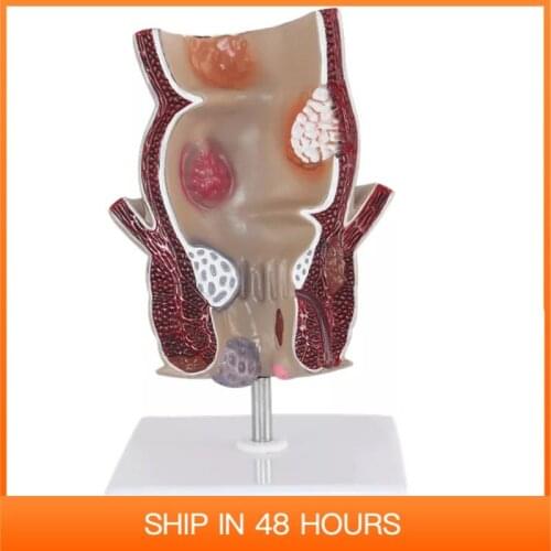 Life Size Rectum Model Human Digestive System Anatomy Medical Teaching Tool PNT-0457 Supplies and Equipment