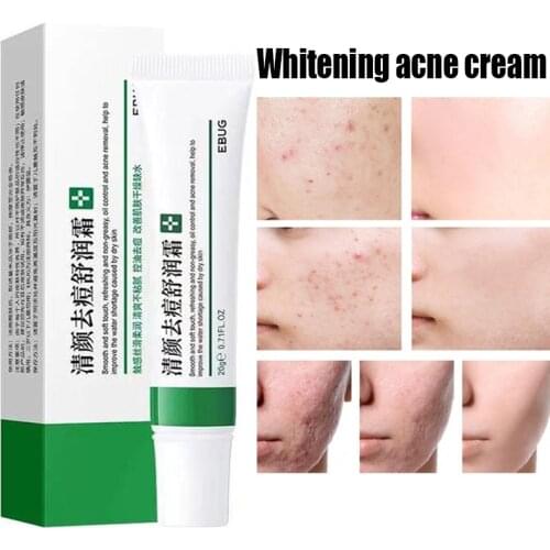 Whitening Acne Freckle Cream Remove Acne Treatment Melanin Spot Pigmentation Skin Care Moisturizing Whitening Cream 20g