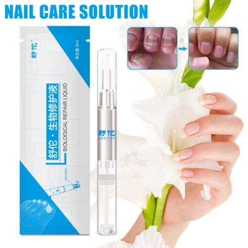 3ml Nail Fungus Treatment Liquid Anti Fungal Finger Toe Nail care solution Professional Herb Nails Treatment Liquid