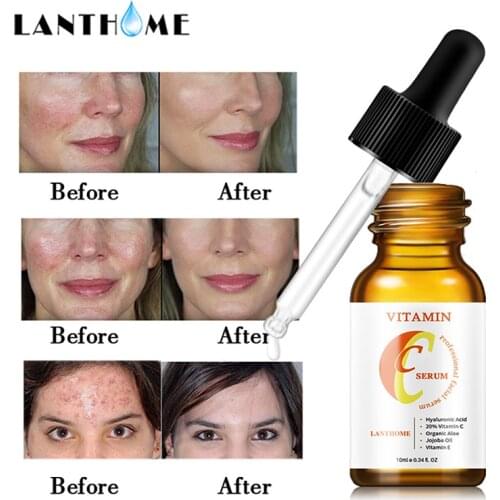 LANTHOME Vitamin C Face Serum Hyaluronic Acid Whitening Face Essence Freckle Anti Wrinkles Moisturizing Face Care Cream