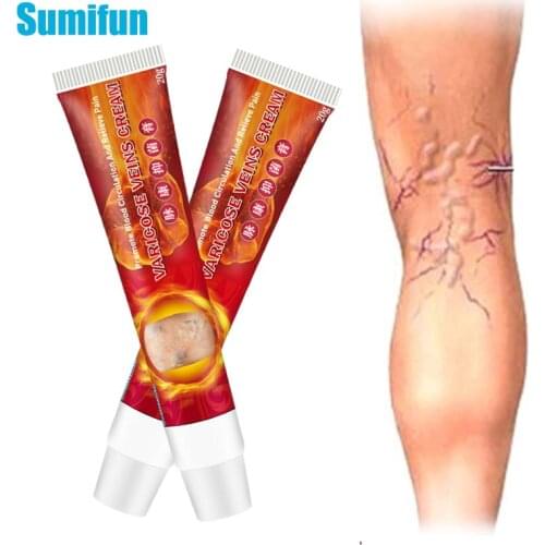 1Pcs 20g Varicose Veins Cream Anti-swelling Red Capillary Vasculitis Treatment Pain Relief Ointment Herbal Medical Plaster