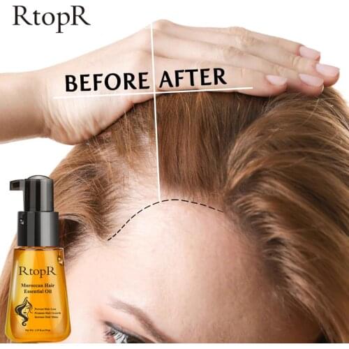 Moroccan Prevent Hair Loss Product Hair Growth Essential Oil Easy To Carry Hair Care Nursing 35ml Both Male and Female Can Use