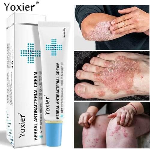 Plant Eczema Psoriasis Cream Antibacterial Dermatitis Athletes Foot Relieve Itching Irritation Allergies Lithospermum Body Care