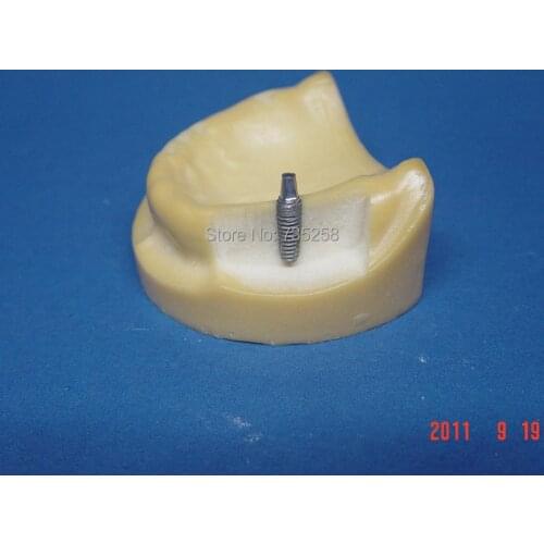 Senior Teeth Planting Practice Model,Teeth Planting Model,Tooth Model,Tooth Jaws Model