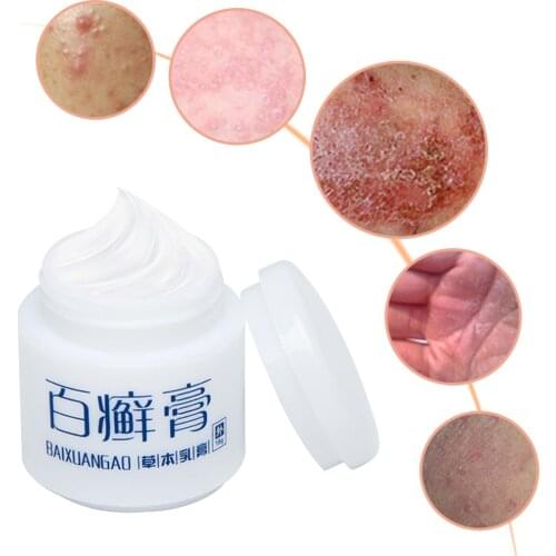 Eczema Cream Dermatitis Psoriasis Antibacterial Ointment Anti-itching