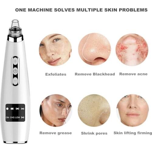 Blackhead Black Dot Remover Face Vacuum Skin Care Acne Pore Cleaner Pimple Removal Vacuum Suction Pore Cleaner Extractor Tool