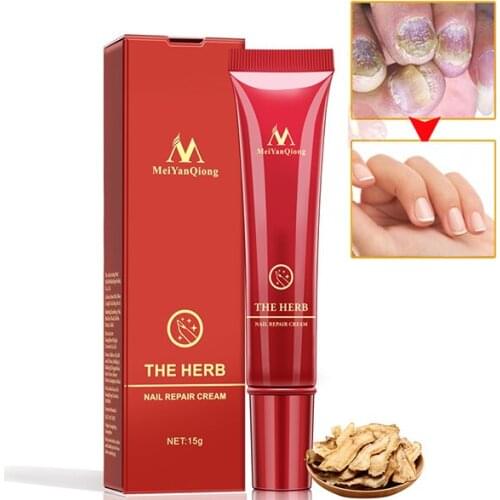 Dropshipping Nail Foot Protector Skin Care Cream Nail Fungus Treatment Herb Nails Repair Cream Nail Care Foot Creamare