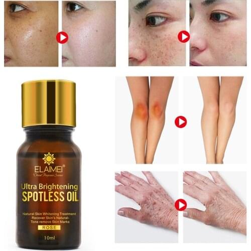 Эфирные масла SZYDIT China At AliExpress