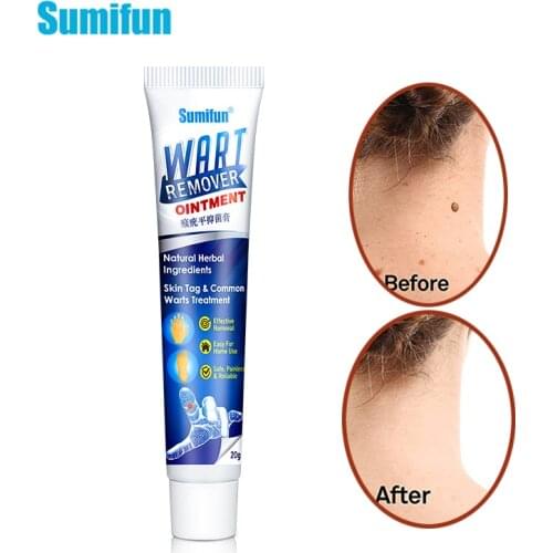 1pcs Sumifun Wart Remover Cream Herbal Antibacterial Ointment Foot Corn Skin Tag Remover Thorn Pain Relief Medical Plaster P1164