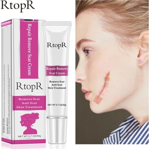 RtopR Acne Scar Stretch Marks Remover Cream Skin Repair Face Cream Blackhead Whitening Cream Acne Spots Acne Treatment Skin Care