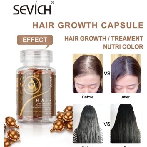 Sevich 30pcs/bottle Hair Growth Capsule Ginger Growth Hair Vintamin Capsule Anti-Loss Treatment For Thinning Hair Hair Care