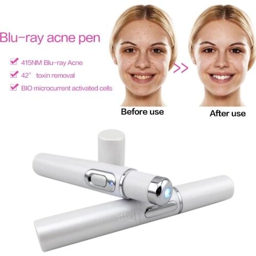 Protable Blue Light Acne Treatment Pen BIO Current Aging Therapy Anti-Wrinkle Scar Varicose Veins Laser Pen for Varicose Veins