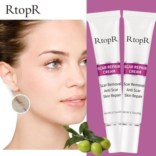 Acne Scar Stretch Marks Remover Cream Skin Repair Face Cream Acne Spots Acne Treatment Blackhead Whitening Cream Skin Care 2 box