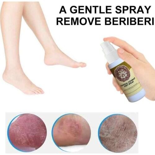 60ml Herbal Extract Foot Sterilization Spray Infections Athletes Foot Spray For Beriberi Itch Erosion Peeling Blisters Anti