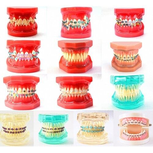 Dental Oral Care Tooth Teeth Model Dental Orthodontic Model for Patient Communication Dentist Study Model
