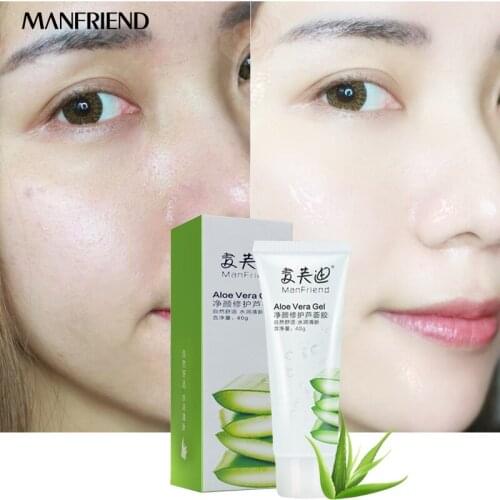 Aloe Vera Gel Can Nourish The Injured Skin After Sun Exposure Natural Aloe Extract Formula Nutrition Supplement Hydrate Makes