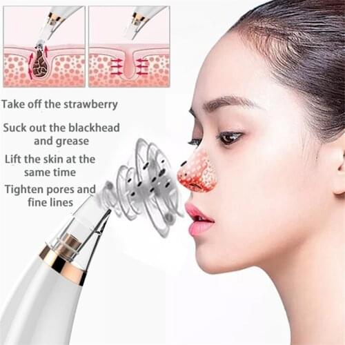 Blackhead Remover Skin Care Pore Vacuum Acne Pimple Removal Vacuum Suction Tool Facial Diamond Dermabrasion Machine Face Clean