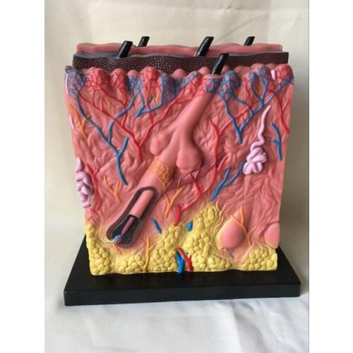 Quality PVC Human Skin Anatomical Model Acne Epidermis Anatomy Pathological Skin Anatomy Human Medical Teaching Model 34X34X16CM