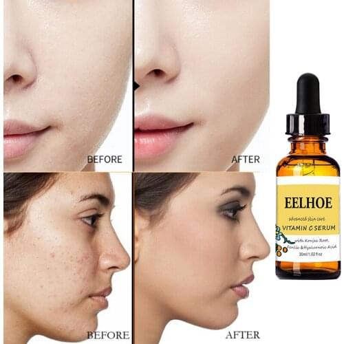 Vitamin C Facial Serum Anti-aging Pore Shrinking Whitening Moisturizing Shrink Pores Cream Dry Skin Care 30ml