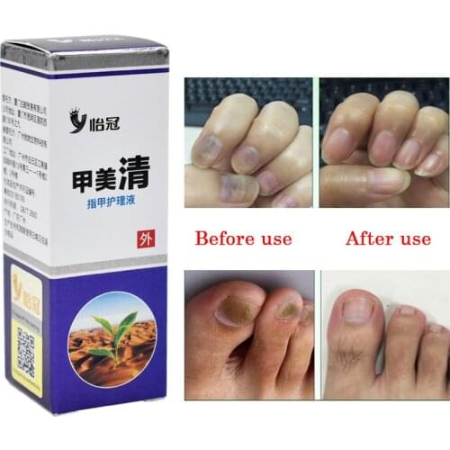 MeiYanQiong Hand And Foot Care Products