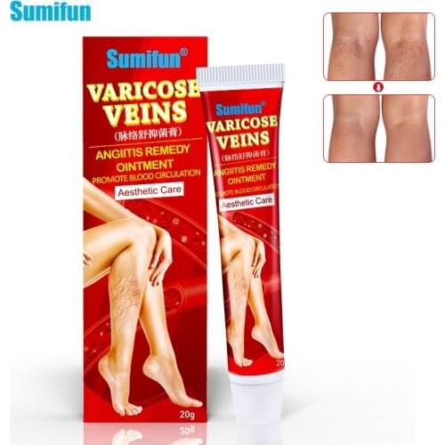 Sumifun 1Box Varicose Vein Treatment Cream Herbal Medical Ointment Phlebitis Spider Removal Cream Vasculitisleg Massage K10011
