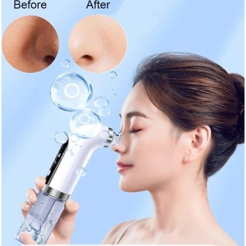 Electric Blackhead Remover Bubble Face Cleaner Vacuum Suction Pore Acne Pimple Black Head Removal Facial Skin Care Beauty Device