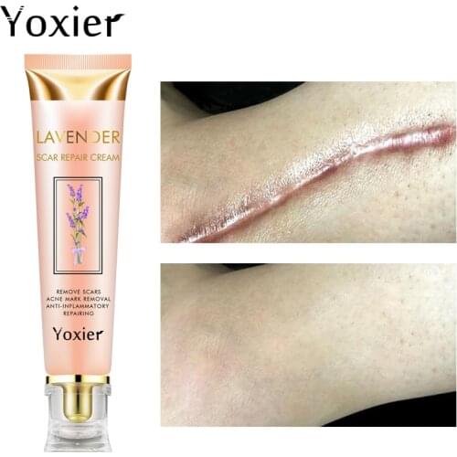 Lavender Scar Repair Cream Repairing Removing Burn Scars Promote Cell Regeneration Enhance Elasticity Cucumber Skin Care 20g