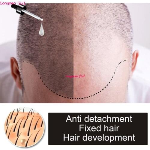 Plant Extracts Hair Growth Essential Ginger Polygonum Multiflorum Ginger Anti Hair Loss Nourishing Growth Hair Growth Aromather