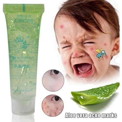 Aloe Vera Gel Soothing Moisturizing Heals Skin Moisture Cream Skin Care MU8669