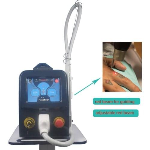 High efficiency nd yag laser 532nm 1064nm q-switched picosecond laser tattoo removal machine