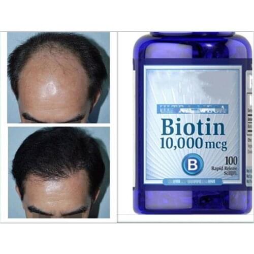 2 Bottles Biotin Adult B7 Vitamin H Prevent Hair Loss Hair Health 100 pcs /bottle