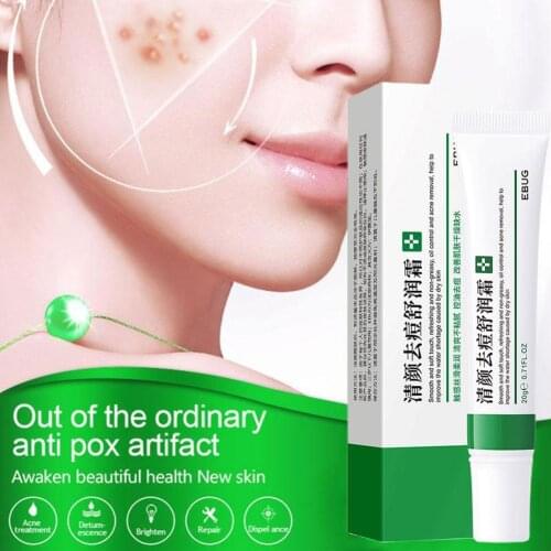 Acne Removal Cream Fade Acne Control Shrink Pores Whitening Moisturizing Acne Cream Skin Care Acne Treatment Face Cream