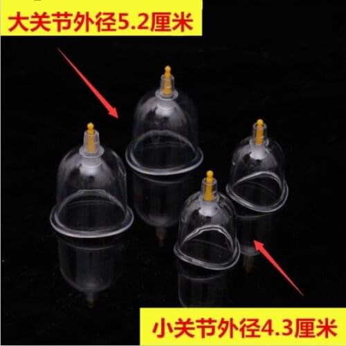 B1/B2/B3/B4/B5/B6/B7/U2/U4 Vacuum cup cans joint vaccuum cupping accessories
