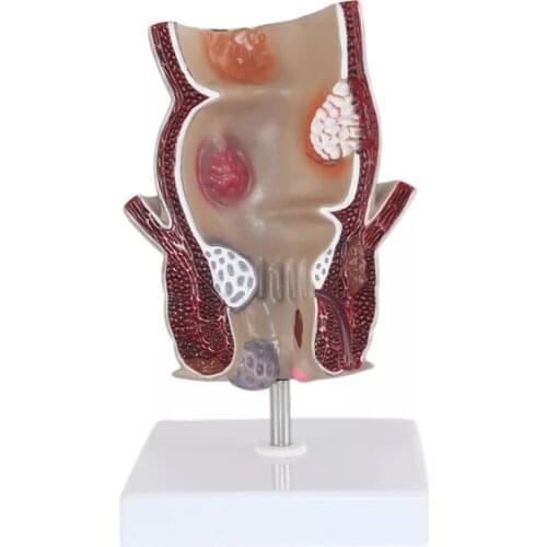 Life Size Rectum Model Human Digestive System Anatomy Medical Teaching Tool PNT-0457 Medical Supplies and Equipment