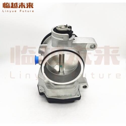 NEW Throttle Body For Renault OE 8200063652 8200083206 8200051274 8200123061 8200059268 93160202 408239822001 408239822001Z