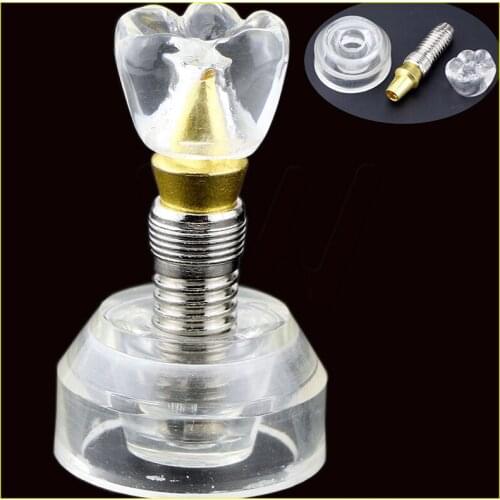 Dental Implant Model Single Clear Teeth stand implant crown 3 parts Tooth