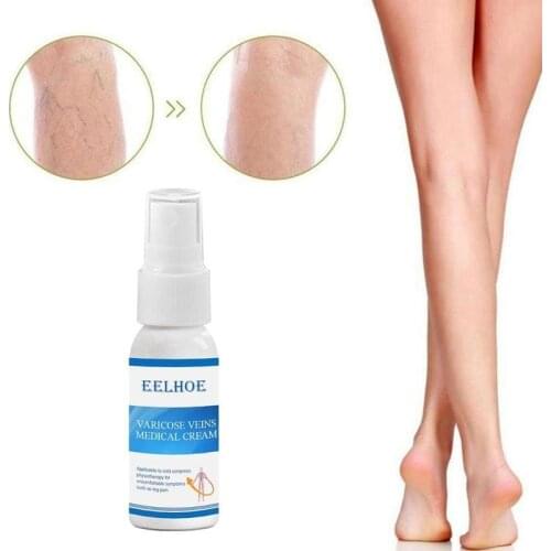 Varicose Vein Soothing Spray Vasculitis Treatment Liquid On Leg Acid Bilges Itching Earth Worm Lumps Legs Cure Natural Solution