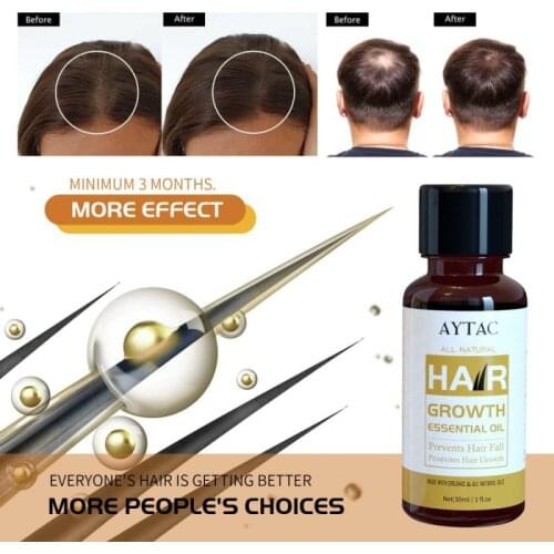 30ml Hair Care Essential Oils Nourish Repair Hair Root Regeneration Conditioner Anti Hair Loss Liquid Hair Growth Serum TSLM1