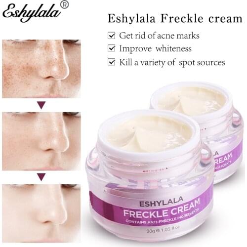 Eshylala Whitening Freckle Cream Remove Melasma Acne Spot Pigment Melanin Dark Spots Face Cream Moisturizing Skin Care
