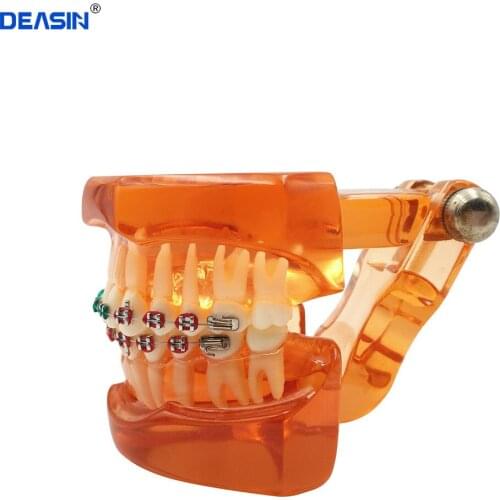 Dental Orthodontic Teeth Model with metal and ceramic bracket/Dental Orthodontic traning teeth model