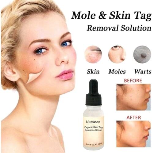 Mighty Tag & Spots Remover Serum Painless Mole Skin Dark Spot Mole Removal Face Wart Tag Freckle Skin Tag Removal Cream