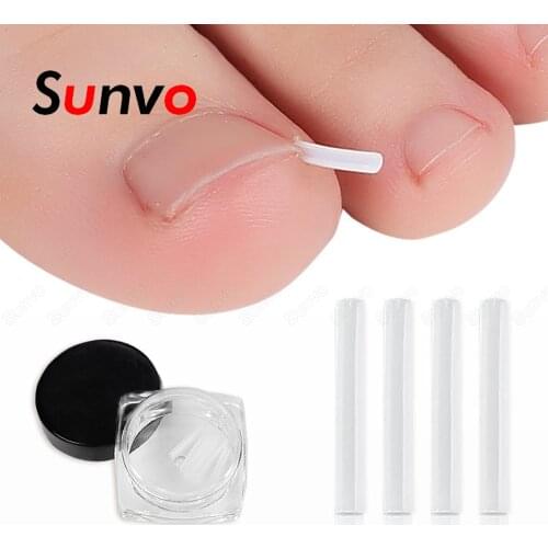 10pcs/set Ingrown Toenail Corrector Foot Pad Filler Nail Sticker Straightening Ingrown Correction Patch Foot Care Pedicure Tools