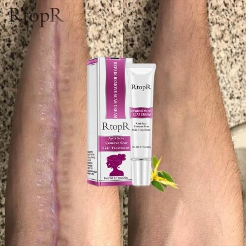 RtopR Acne Scar Stretch Marks Remover Cream Skin Repair Face Cream Acne Spots Acne Treatment Blackhead Whitening Cream Skin Care