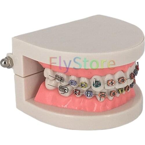 1pc Dental Orthodontic Tooth Model TreatmentWith Ortho Metal Ceramic Bracket Arch Wire Buccal Tube Ligature Ties