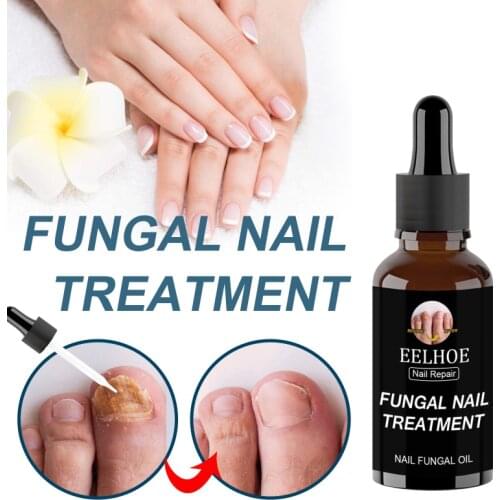 Eelhoe Foot Hand Antifungal Drugs Nail Fungus Treating Liquid Repair Liquid Onychomycosis Removal Nail Care Repair Fluid TSLM1