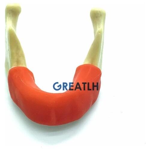 Dental Implant practise Teeth model Mandible Jaw With Soft Tissue with gum for Dental Training model Tool