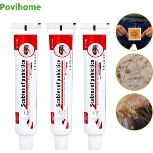 3Pcs Anti-itching Ointment Head Lice Mites Removal Treatment Scabies Antibacterial Cream Herbal Medical Plaster Body Skin Care