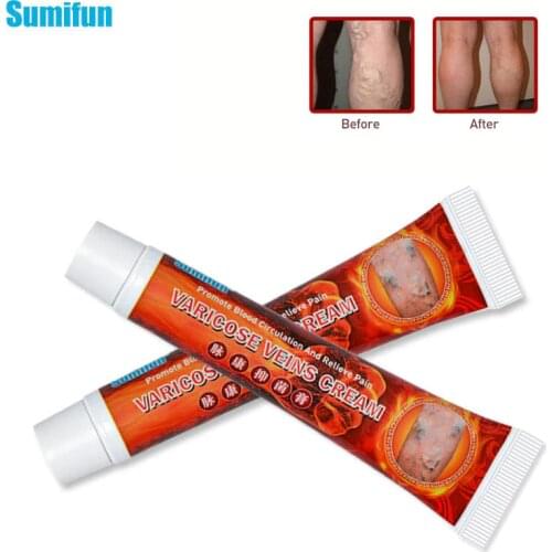 Sumifun 2020 New Varicose Veins Cream Vasculitis Phlebitis Spider Cream Varicosity Angiitis Removal Herbal Medical Plaster Oil