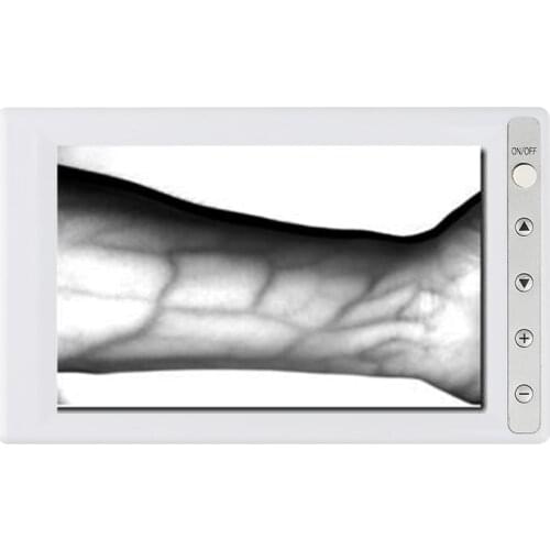 LCD Blood vessel display, finder, imager, venography, detector, vein finder